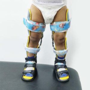Children blount disease orthosis for walking