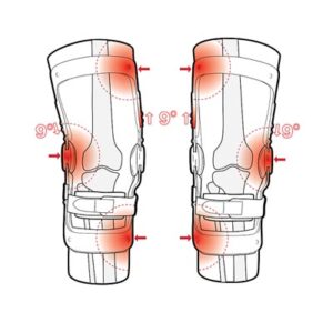 Thuasne OA knee brace 1
