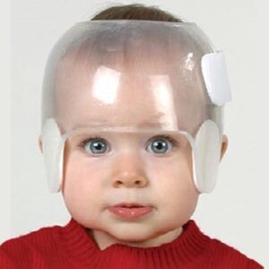 Transparent Cranial Molding Helmet